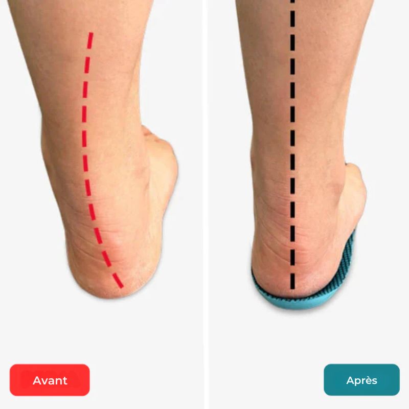 Semelles Orthopédiques Respirants – Image 6